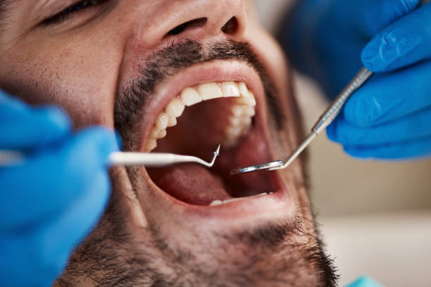 Full Mouth Reconstruction in Lorain, OH